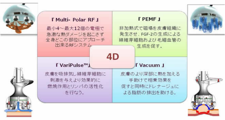 ヴィーナスレガシー